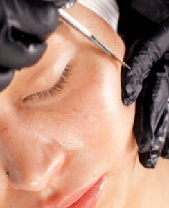 close up of a woman's cheek during dermaplaning service.