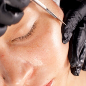 close up of a woman's cheek during dermaplaning service.